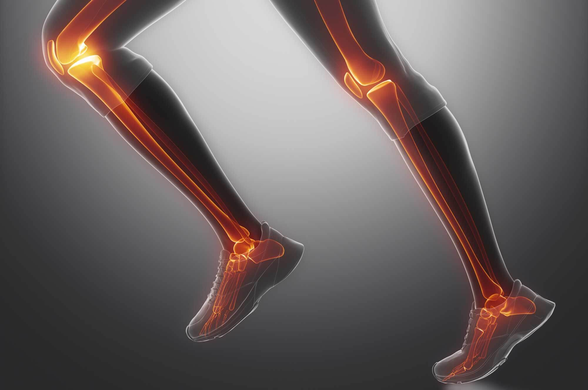 Square One - Running Gait Analysis Rehabilitation: Image showing legs in running position similar to an xray